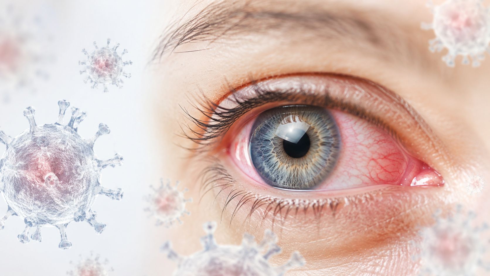 Virus Infection Eye: Symptoms, Causes & Treatment Guide